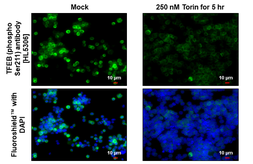 Anti-TFEB (phospho Ser211) antibody [HL5306] used in Immunocytochemistry/ Immunofluorescence (ICC/IF). GTX645771